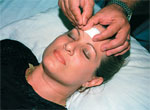 Treatment with acupuncture